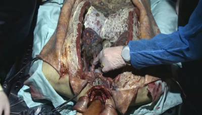 Штамм 1, 2, 3 сезон